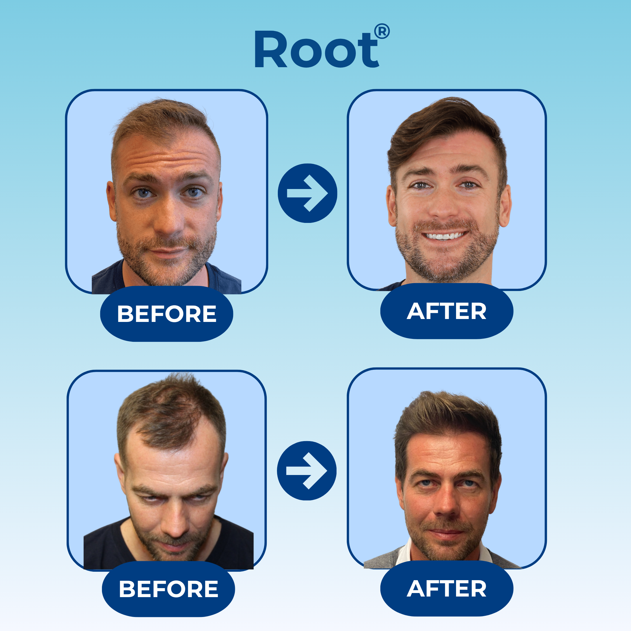 Root® Signature Hair Growth Serum Roller