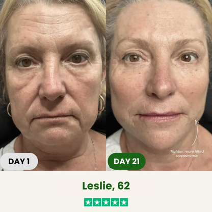 SCULPTA Jawline Kit®