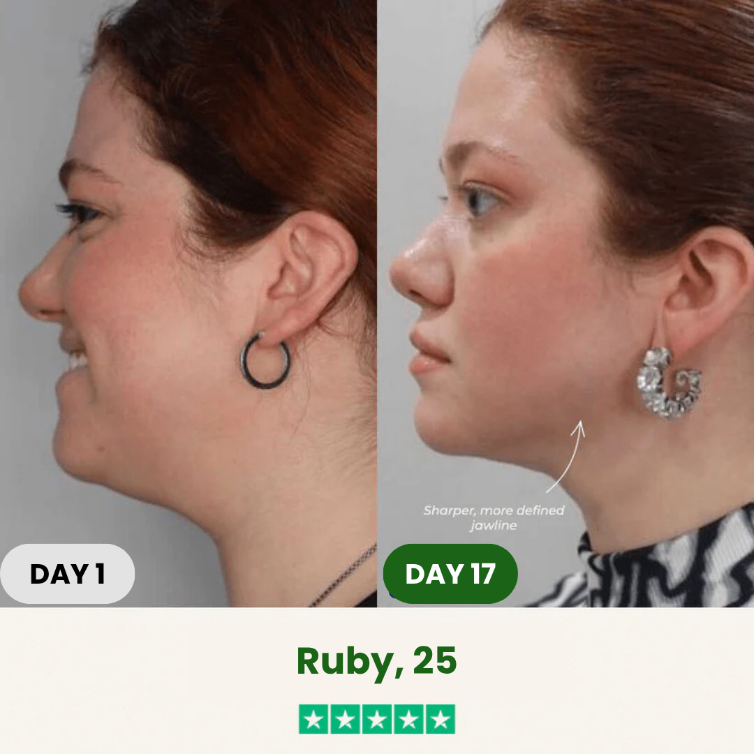 SCULPTA Jawline Kit®